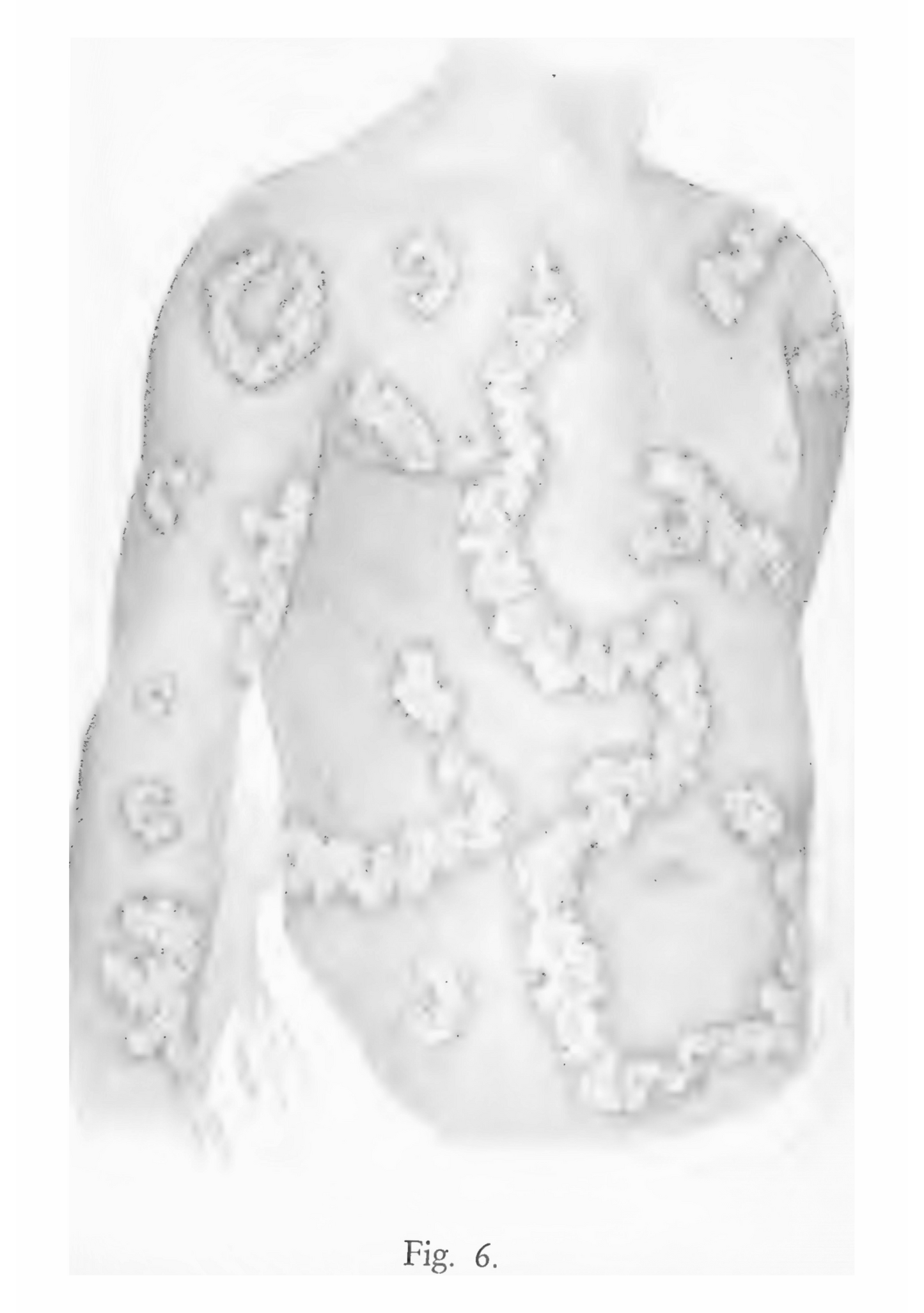Atlas of Skin Diseases