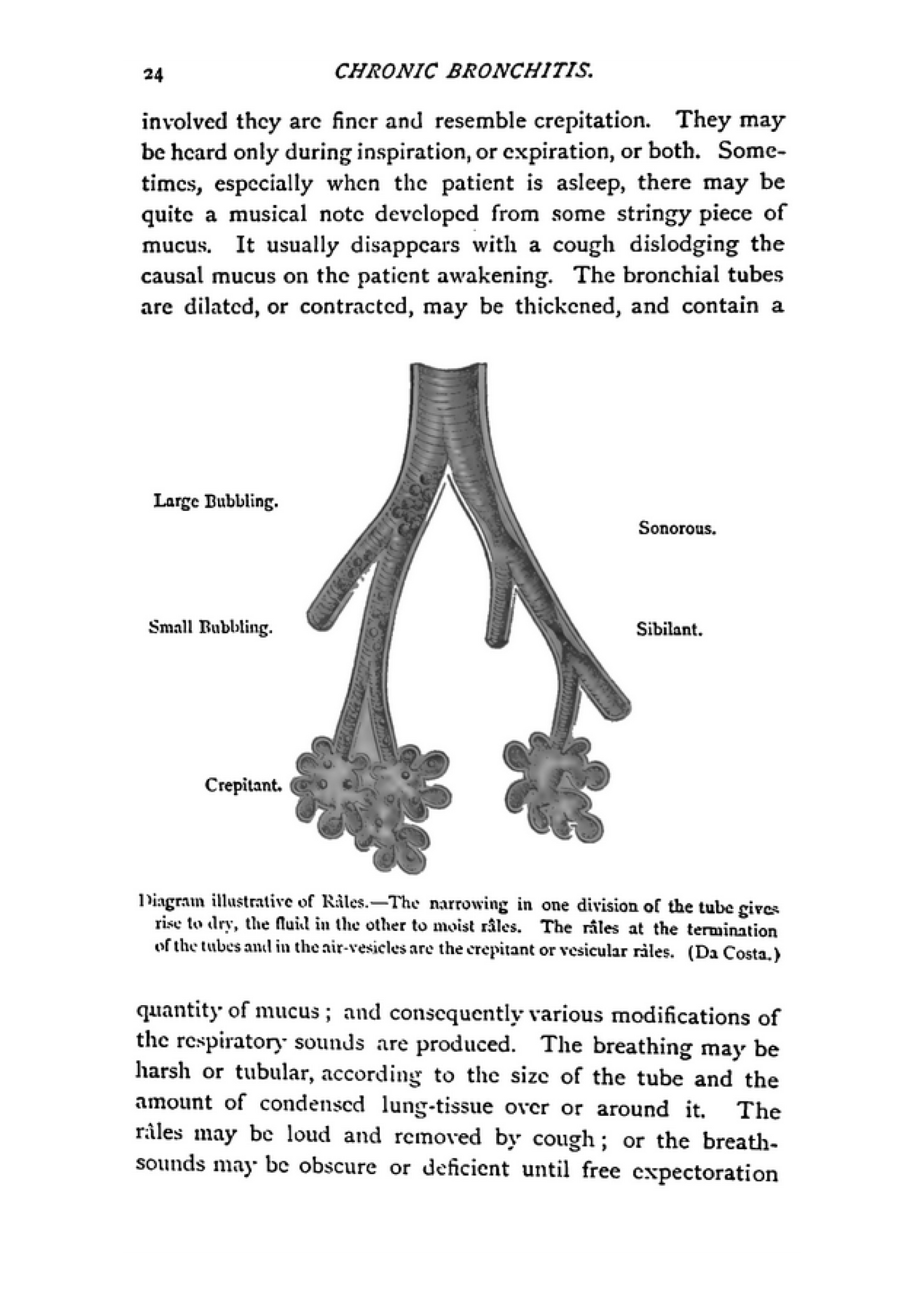 Chronic Bronchitis - Its Forms and Treatment