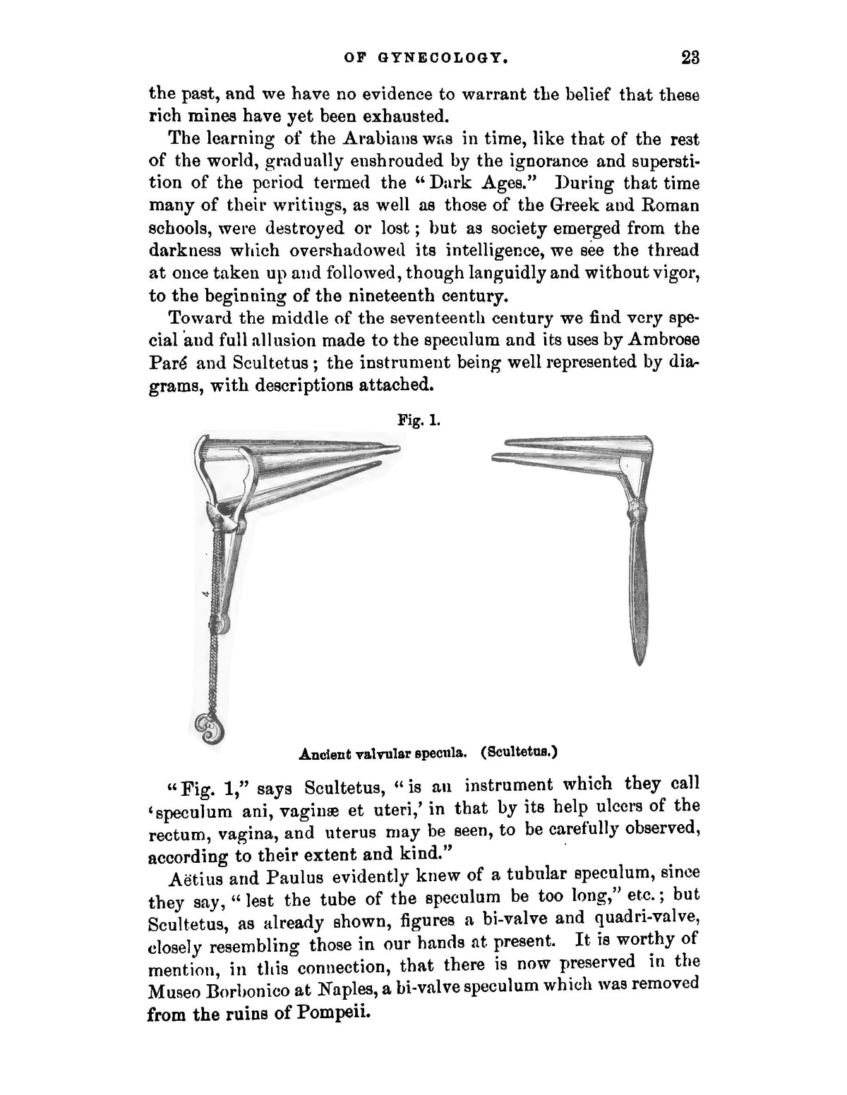 A Practical Treatise on the Diseases of Women - Page 31