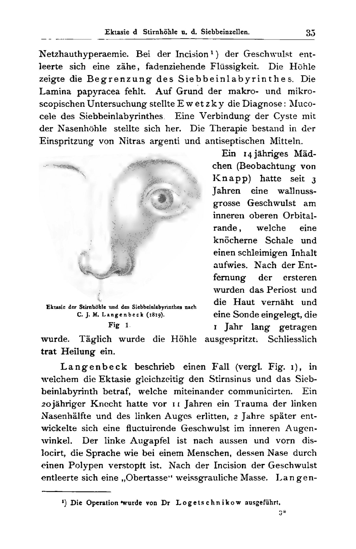 Die Krankheiten der Keilbein-Höhle und des Siebbein-Labyrinthes - Page 45
