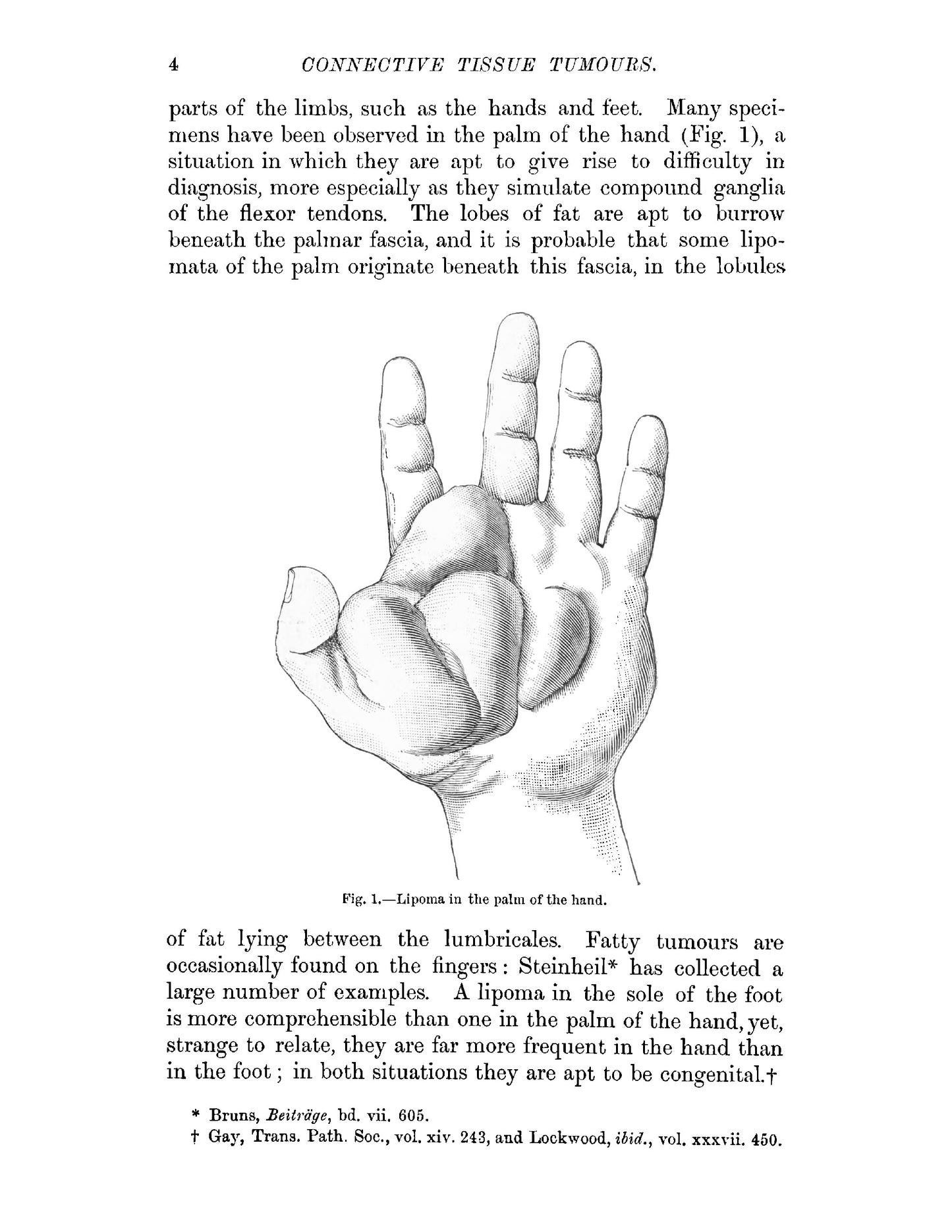 Tumours - Page 22