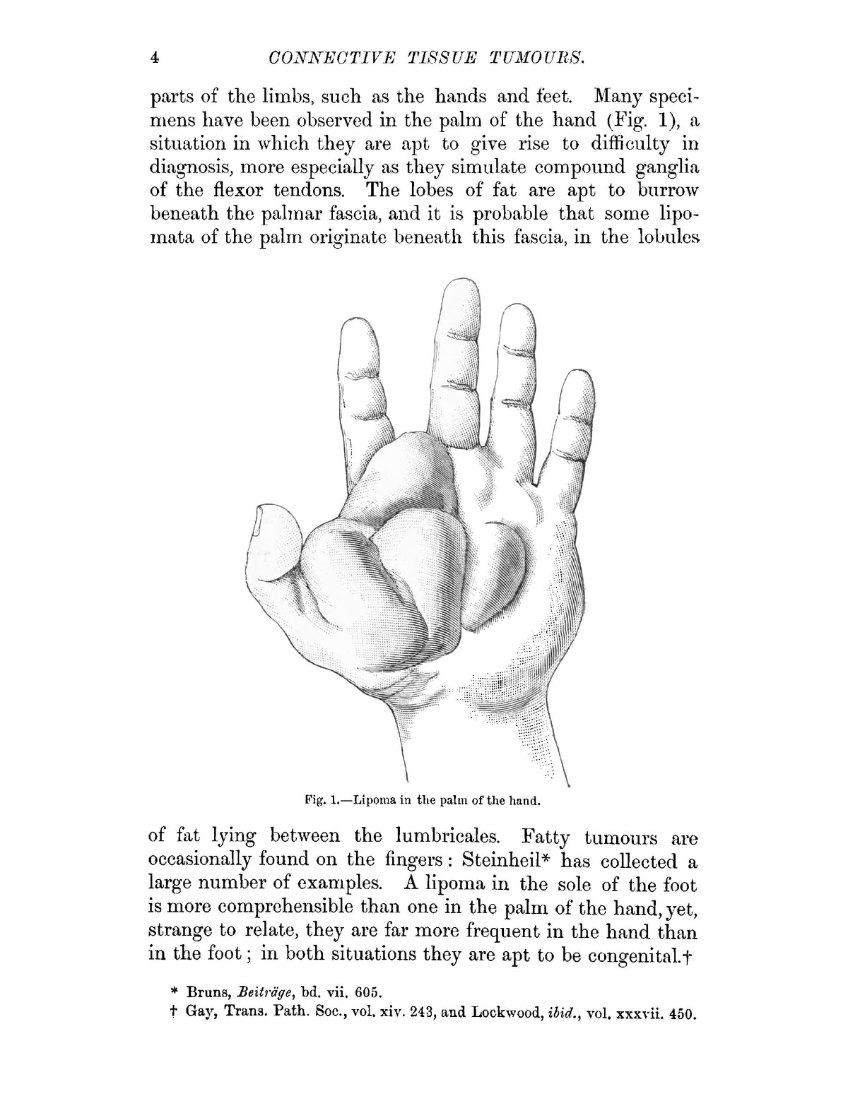 Tumours - Page 22