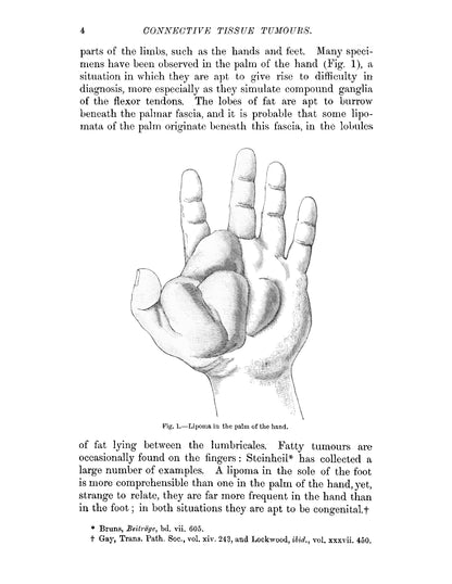Tumours - Page 22