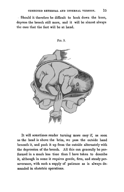 On combined External and Internal Version - Page 25