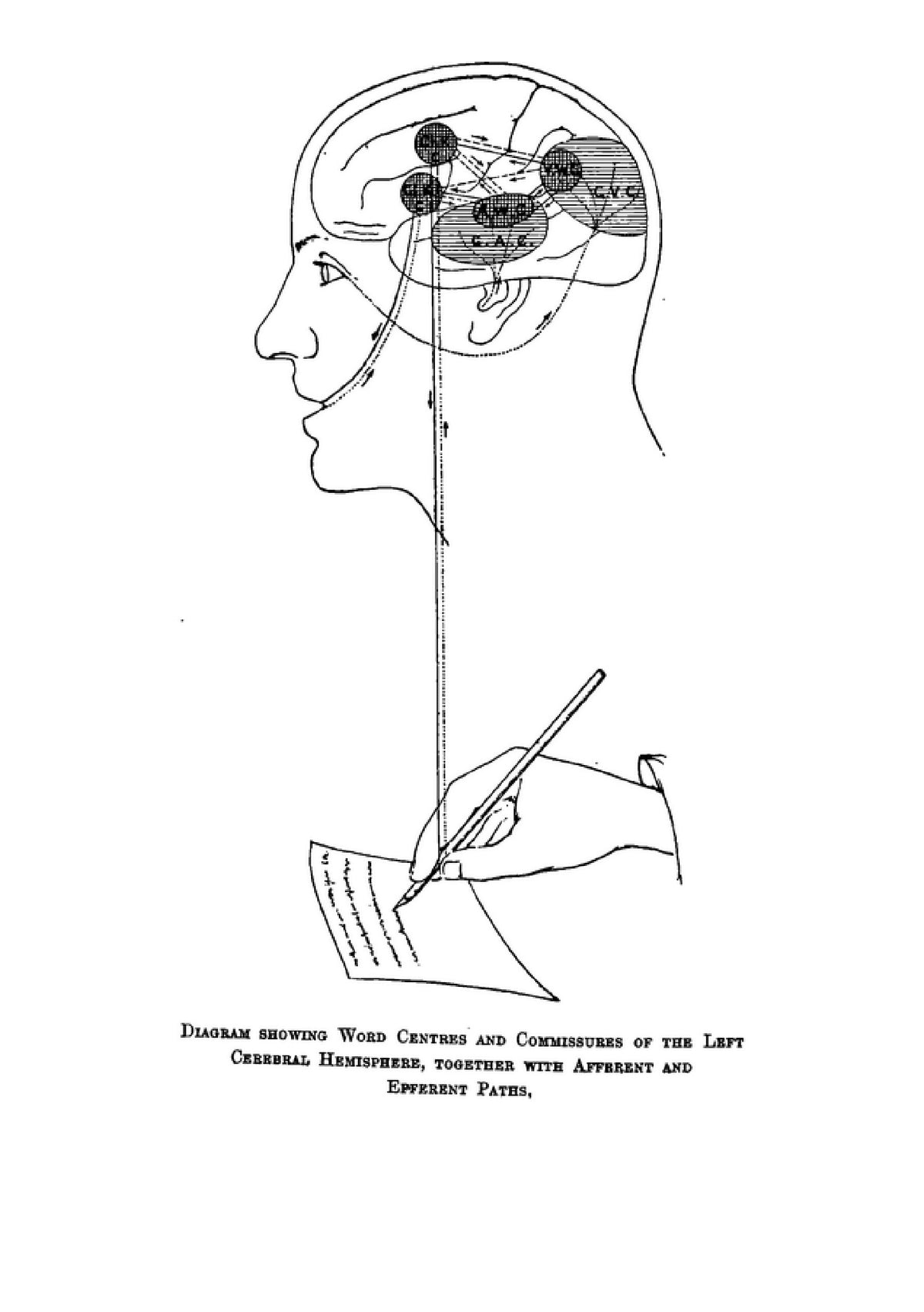 A Treatise on Aphasia and other Speech Defects - Page 6